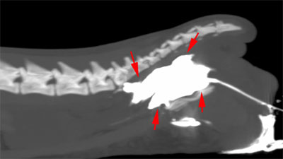 CT scan