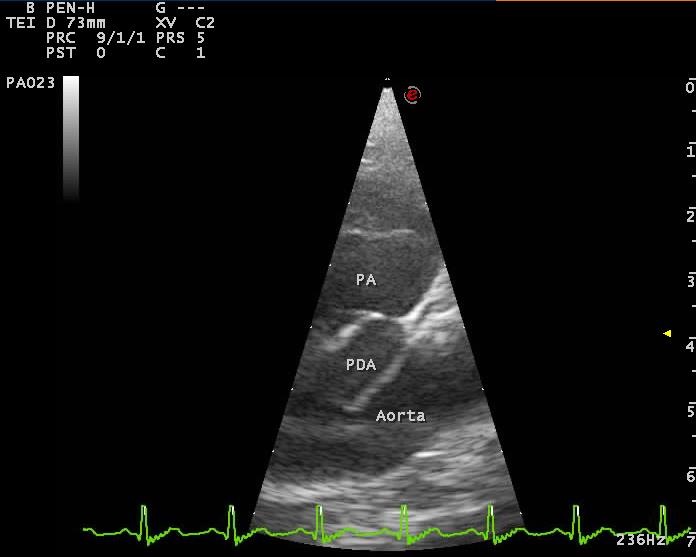 echocardiogram 