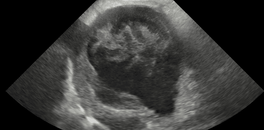 Freddie’s gallbladder mucocele